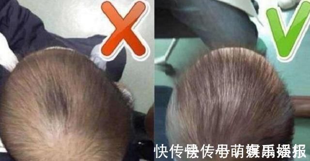 后脑勺|半岁儿子睡成“砖块头”，宝妈想出奇招方法补救，获得医生称赞