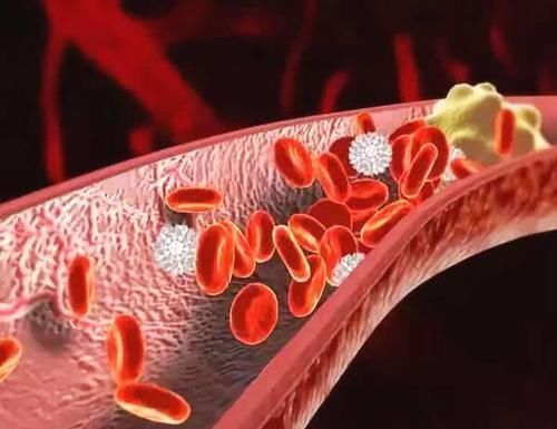 血管|“溶栓高手”被找到,每天喝一杯,清血栓、稀释血液、血管也变好