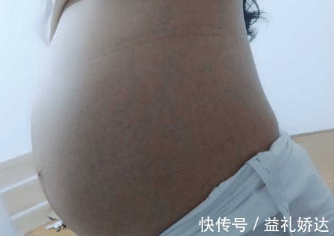 妈妈们|“孕16周梦见蛇了,是什么影响”孕期胎梦暗示什么