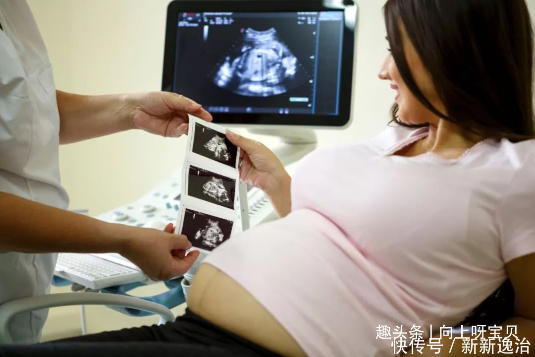胎儿|孕期B超单上3个指标，暗示胎儿健康情况，医生不说孕妈也要清楚