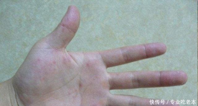 肝好的人，手上会有这4种情况，你若都有，肝脏很健康！