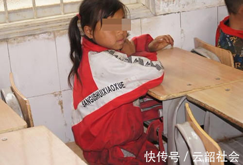 服用|孩子吃保健品吃成“性早熟”?这4类保健品娃不能碰,家长留点心