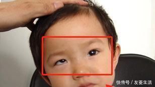 斜视|宝妈有话说,5岁男童老玩这类玩具,导致黑眼珠逐渐“消失”,家长要注意