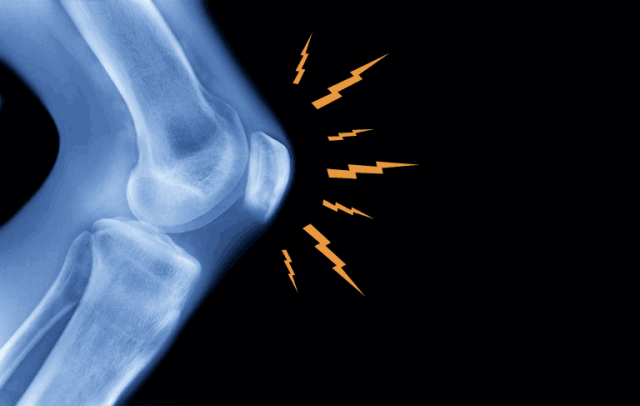 骨关节炎|感觉膝盖发凉？骨科医生教你一个方法“暖”起来