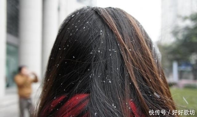 头皮屑|一天不洗，头发就像“下雪”水中放点它！告别头屑烦恼不反复