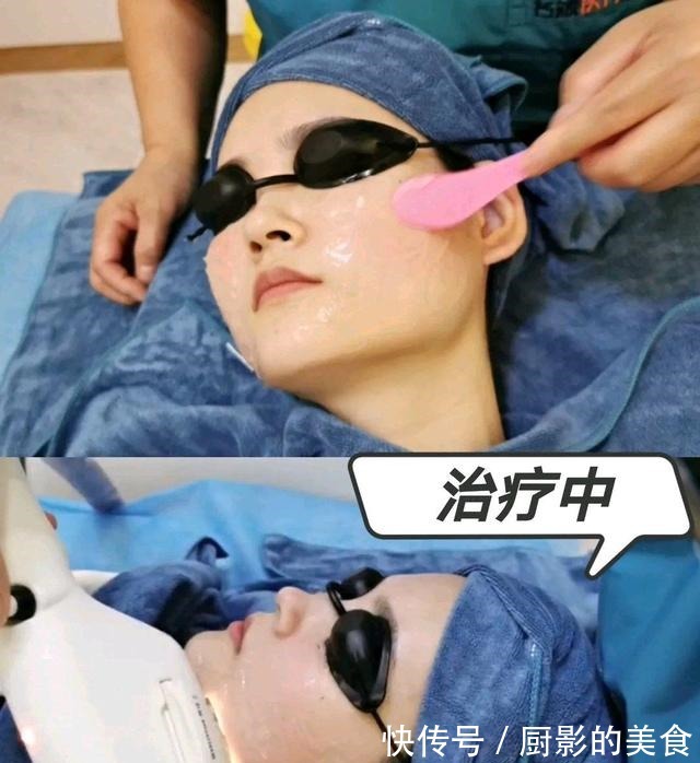 小姐姐 关于光子嫩肤你知道多少!