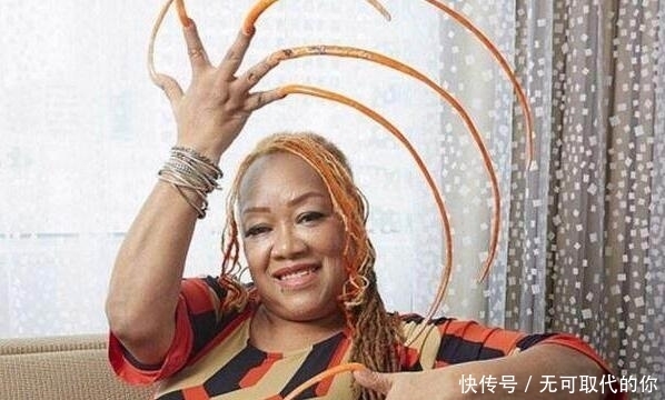 女孩23年来竟没剪过手指甲,都感叹女孩平时怎么上厕所的!