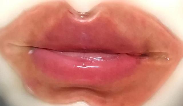 唇皮|嘴唇干裂如何快速“修复”?睡前简单三招,唇干女生“秒变嘟唇”