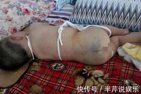 投胎|胎记是投胎时阎王爷打的吗答案可能令你想不到