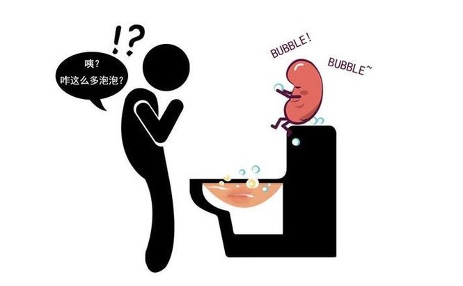 排尿|肾脏好不好,晨尿来揭晓!晨尿具备这3个特征,劝你最好查下肾