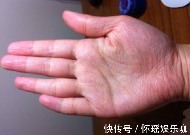 头晕|中医眼里的养生法宝:5个部位“搓一搓”,越搓越长寿,胜吃补品