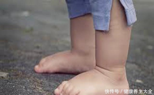 鞋底|5岁女宝双脚变形，只因长期穿这鞋，选鞋“雷坑”很多妈妈还在犯！