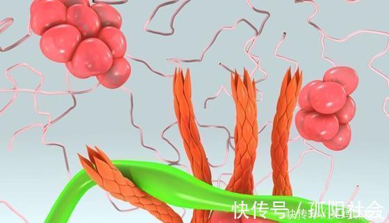 亞油素|轉告父母：甘油三酯高，常吃“一果”，血脂悄悄降