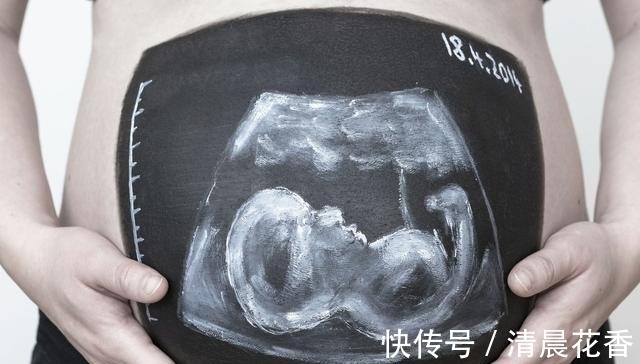 四维|做四维时宝宝趴着不愿意动,原来是这些原因,做好这点一次通过