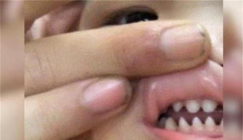 健康|孩子长了一口“鲨鱼牙”,妈妈着急送医,医生:无知害了孩子