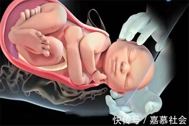 产妇|产道那么小胎儿到底咋出来的?看完这组图泪目了,女人太不容易了