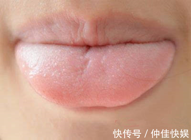 体质|舌是脏腑“本色反映”,8种体质,8种舌象,老中医教你怎么望舌