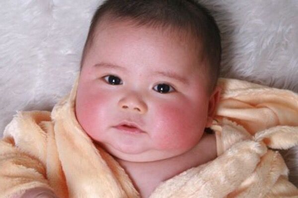 宝妈|孩子如果出现这四种情况可能是积食了,父母一定要注意!