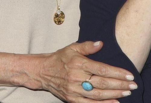  手上|肝癌不痛不痒么，手上的6个变化，或许是肝在向你“发出信号”