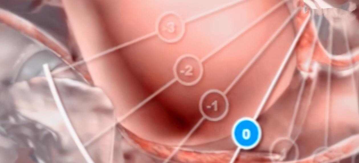 头部|为什么顺产会很痛4张图讲解原因,妈妈没有容易的