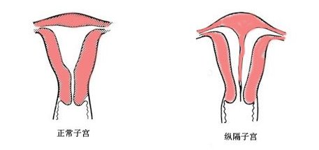 胚胎|复发性流产找上你，可能是因为这些问题