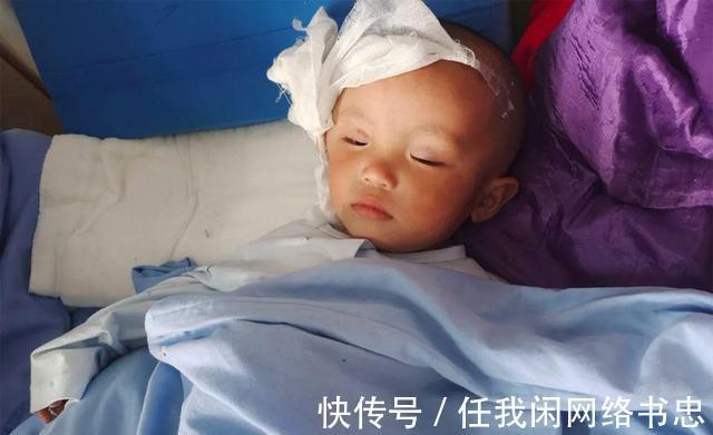 医科大学|男孩发生意外失去半个脑壳,父亲自责,只想给孩子一个正常脑袋