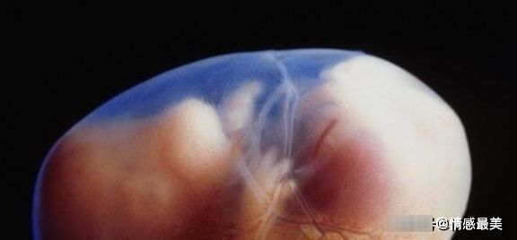 激素分泌|都是怀孕,为何有人孕吐厉害,有人却没事?或许与胎宝有关系!