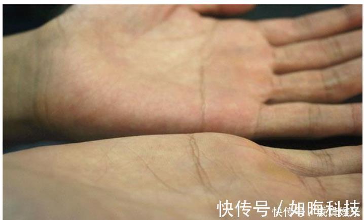 香烟|肺生病了,手和脸会出现“怪像”,如果你一个不占,肺还健康