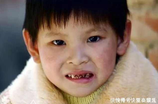 母乳喂|2岁孩子有了小黑牙，可能和糖果无关，跟爸妈的这些坏习惯有关