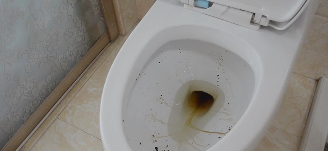 不管马桶多黄多脏, 只需倒一碗它进去, 马桶一冲立马变干净