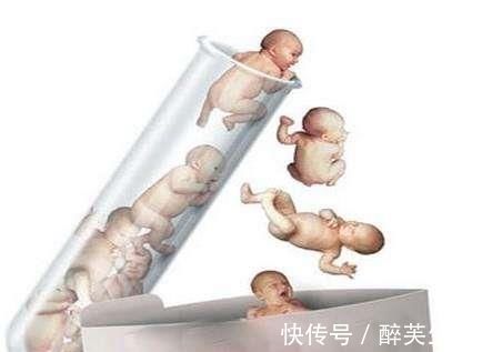 寿命|试管婴儿与普通婴儿，除了受孕方式不一样，还有3点不同，很意外