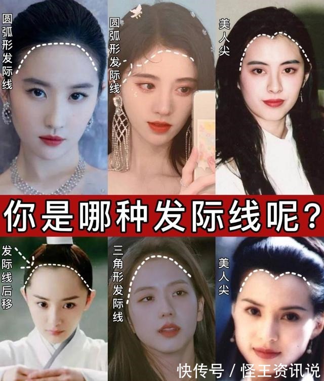 发际线 几种常见的发际线,你又是哪一种呢几分钟教你植发如何选发际线!