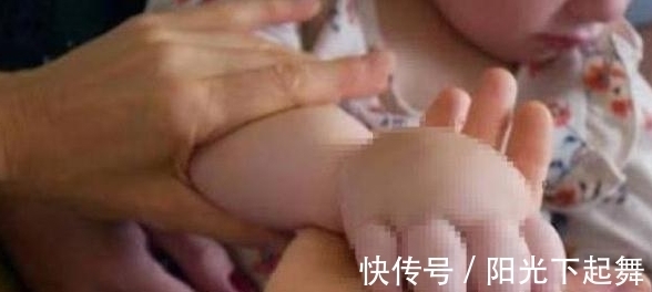手臂|美国两岁女童手如莲藕般,腹部双脚也不断肿大,医生:无药可医!