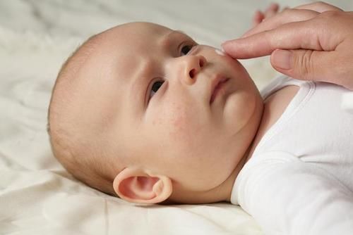 宝宝红屁股、长湿疹了，怎么办？事关孩子的发育，可别乱用婴儿霜