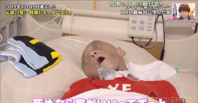 失去舌头的日本乐队主唱,燃尽了整个生命