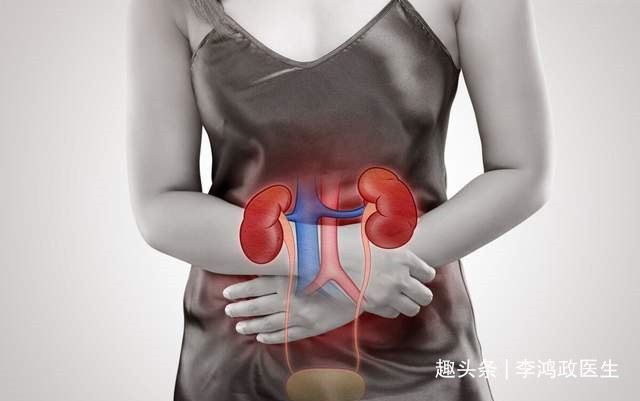 蛋白质|女子双脚水肿，诊断肾病综合征，直到出现咳嗽医生才发现是肺癌