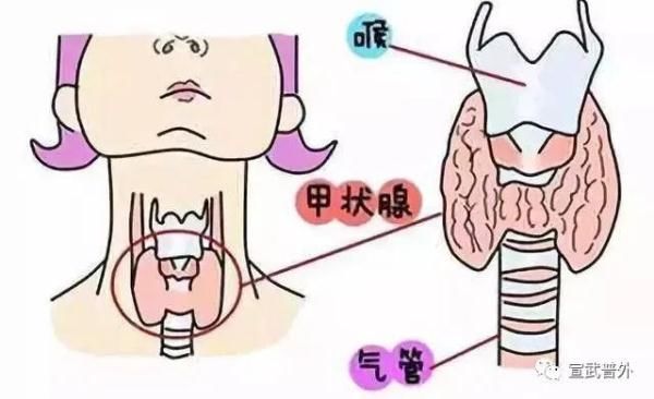 甲状腺功能|怕冷又怕热的小蝴蝶—甲状腺