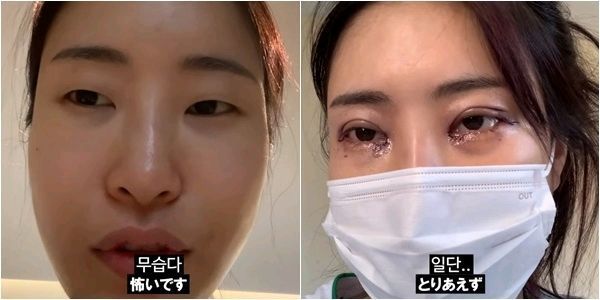 |搞笑女艺人割双眼皮又隆鼻整容?日本男友被化妆术搞懵:不要说谎