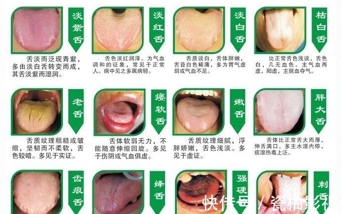 看病|为什么中医看病都要看舌头？教你认识舌苔