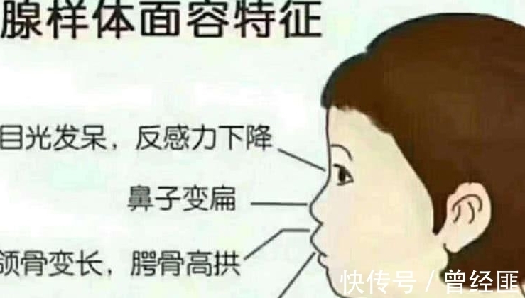 老公|孩子越长越像猴子,老公怀疑老婆整容了,检查结果全家人都吓坏了