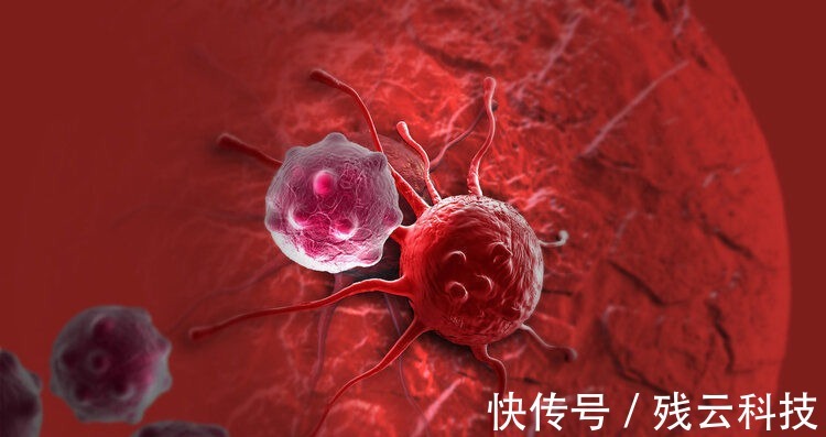 徐院长|抗癌的关键不是手术患癌14年无复发,肿瘤院长劝人别轻易开刀