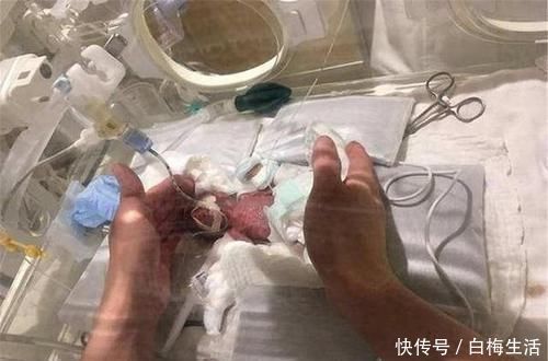 世界上“最小的婴儿”，出生时1斤不到，现已长成挺拔少年