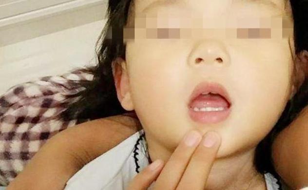 孩子|3岁孙女被鱼刺卡住嗓子,奶奶迅速的反应,被医生赞扬书没白读