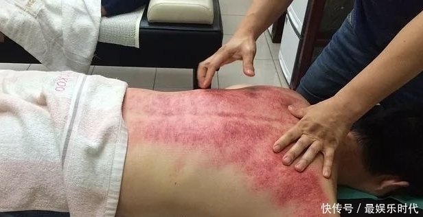 膀胱經絡不疏通，養生全白費！4個方法打通它，身體輕松一整年！