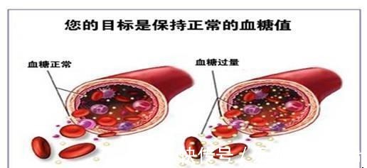 紫菜|內分科主任 糖尿病很怕這6種蔬菜, 糖友多吃點
