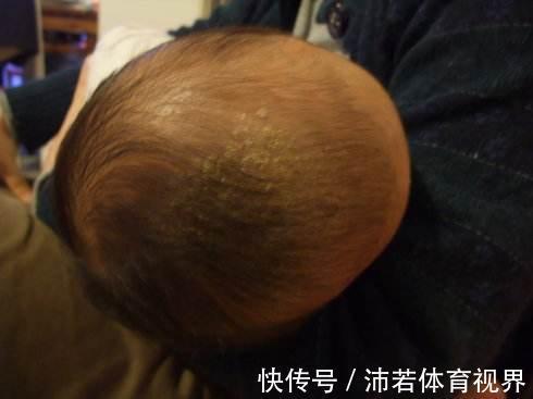 孩子|婴幼儿有4个部位,亲妈也不能动,做父母的可要管住自己的手