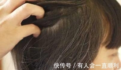惜丝|惜丝:头发变白是怎么回事?快转给你关心的人!