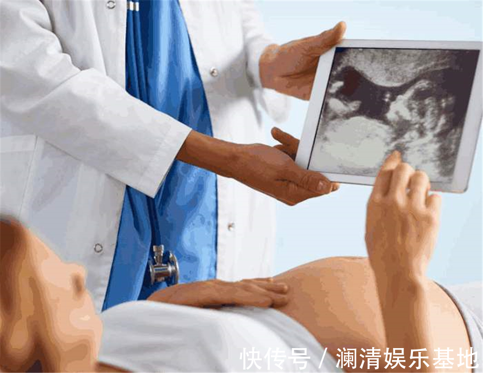 医生|女人一辈子能生几个孩子?医生直言:如果不避孕的话,至少这个数