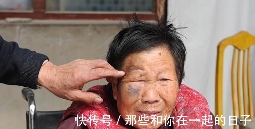 脸部|会不会心梗，看脸就知道了？这种“面相”的人，冠心病的可能性大