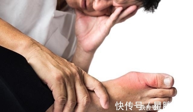 蒲公英|高尿酸患者福音：每天多吃3种食物，有助平衡尿酸，赶走痛风